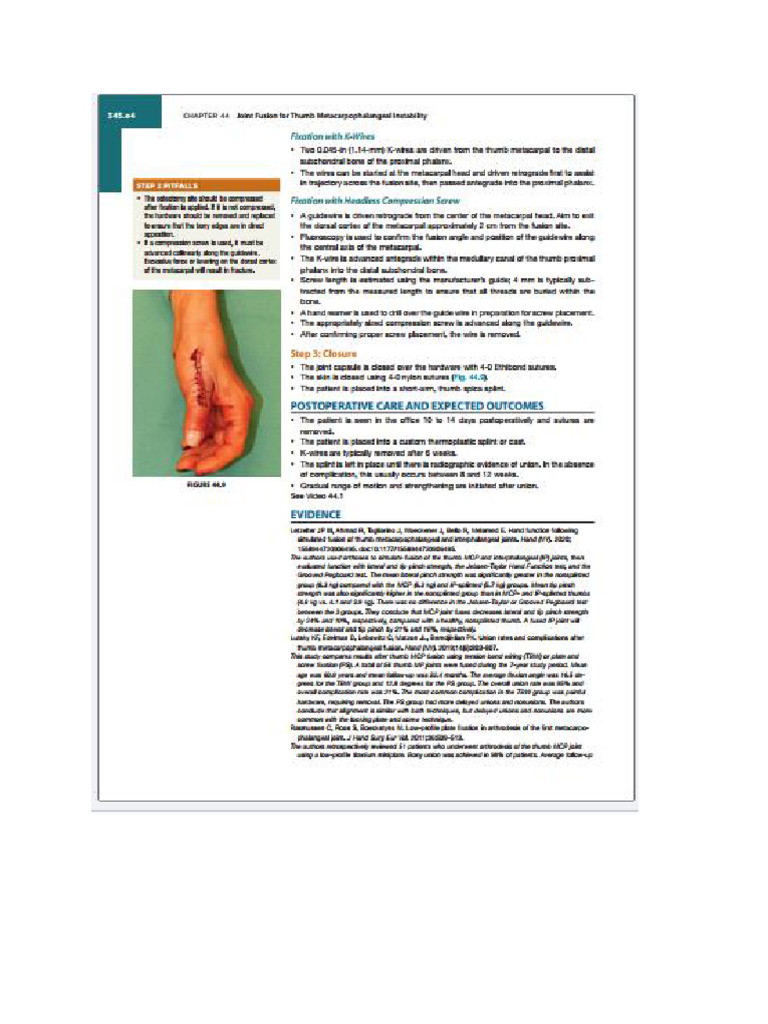 Hand | PDF
