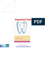 Impacted Tooth