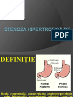 Stenoza Hipertrofica de Pilor