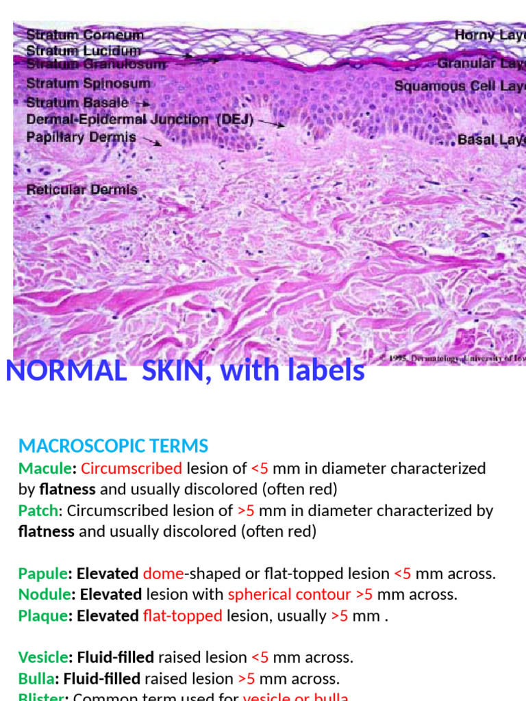 Skin Lesions and Inflammatory Dermatoses | PDF | Cutaneous Conditions ...