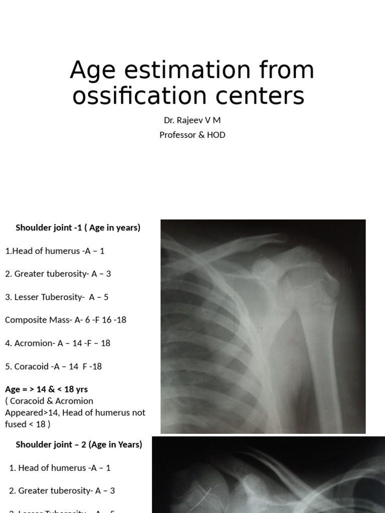 Age Estimation From Ossification Centers New | PDF | Musculoskeletal System