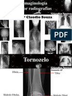 Aula 5 Imaginologia Por Radiografias - Tornozelo, Calcaneo, Pe, Antepe - ProfºClaudio Souza - ATUALIZADO EM 05/2012