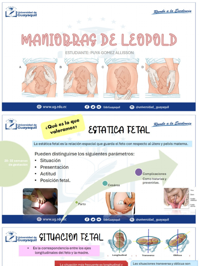 maniobras-de-leopold-y-pdf