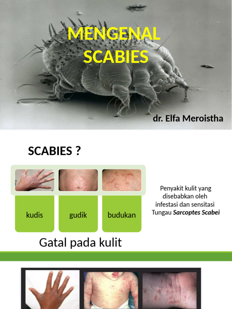 Scabies Lap As | PDF