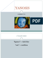 Jamees - Cyanosis Introduction