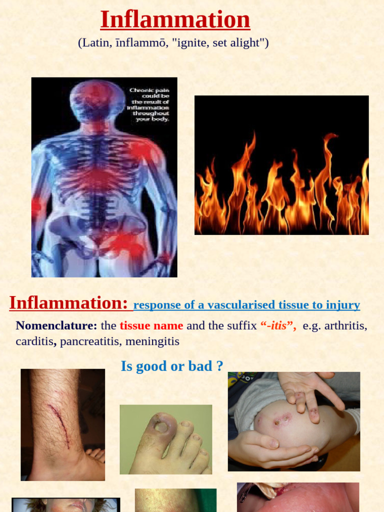 Understanding Inflammation: Causes & Effects | PDF | Inflammation ...