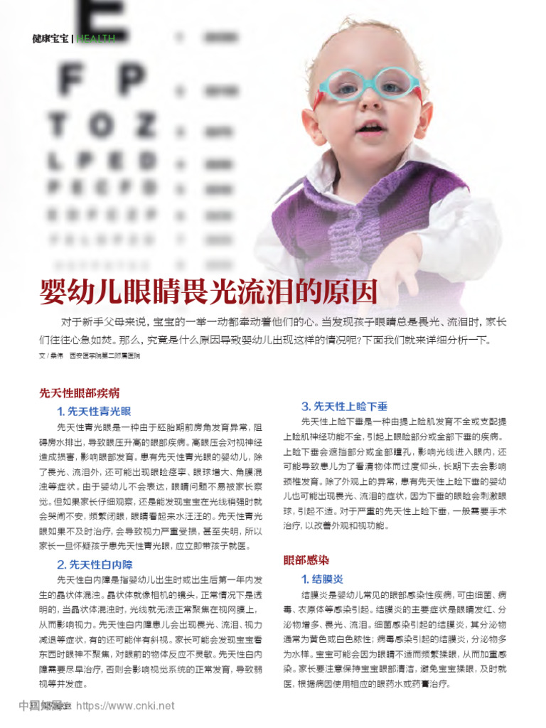 婴幼儿眼睛畏光流泪的原因 桑伟 | PDF