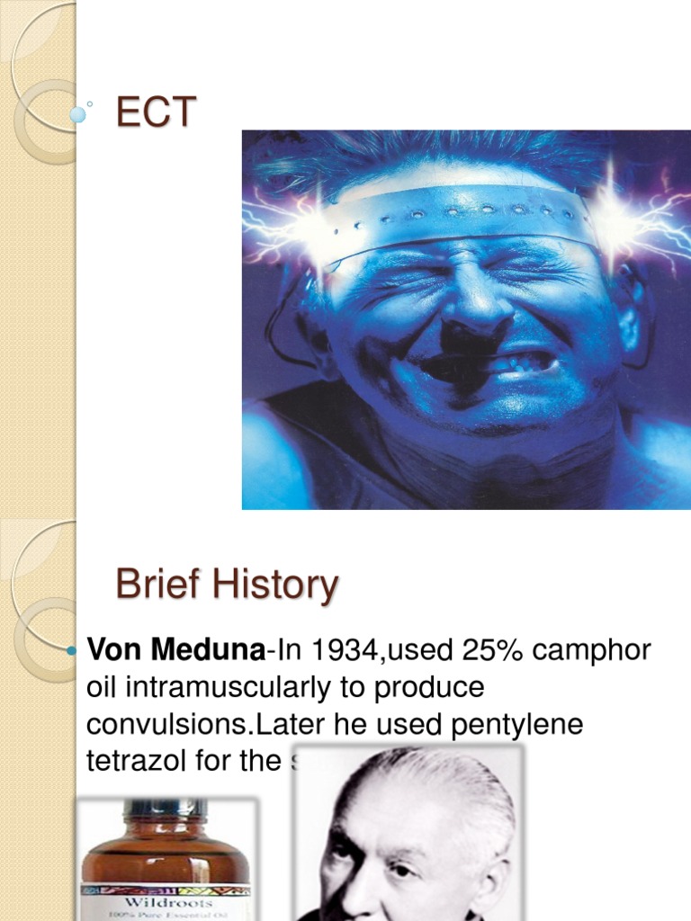 History Of Ect _ Electroshock Therapy: 1940s Origins to Modern Practice ...