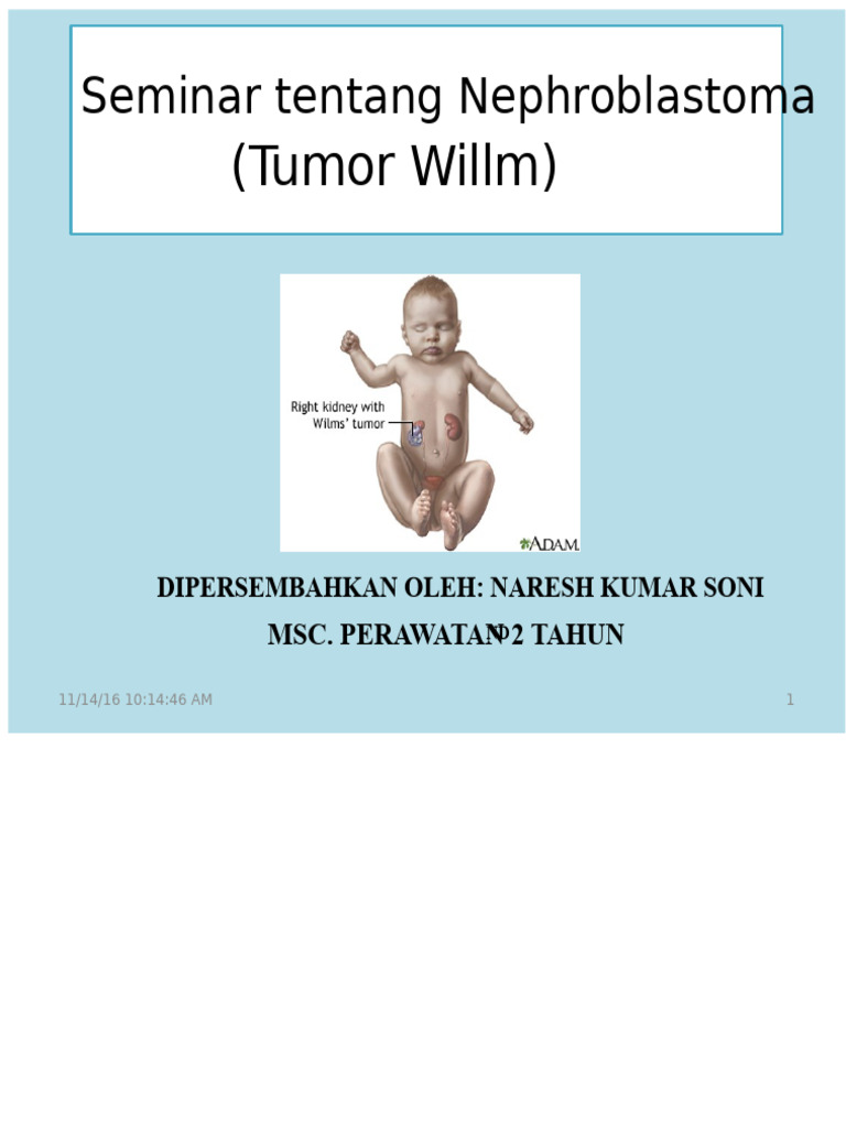 Tumor Wilms | PDF