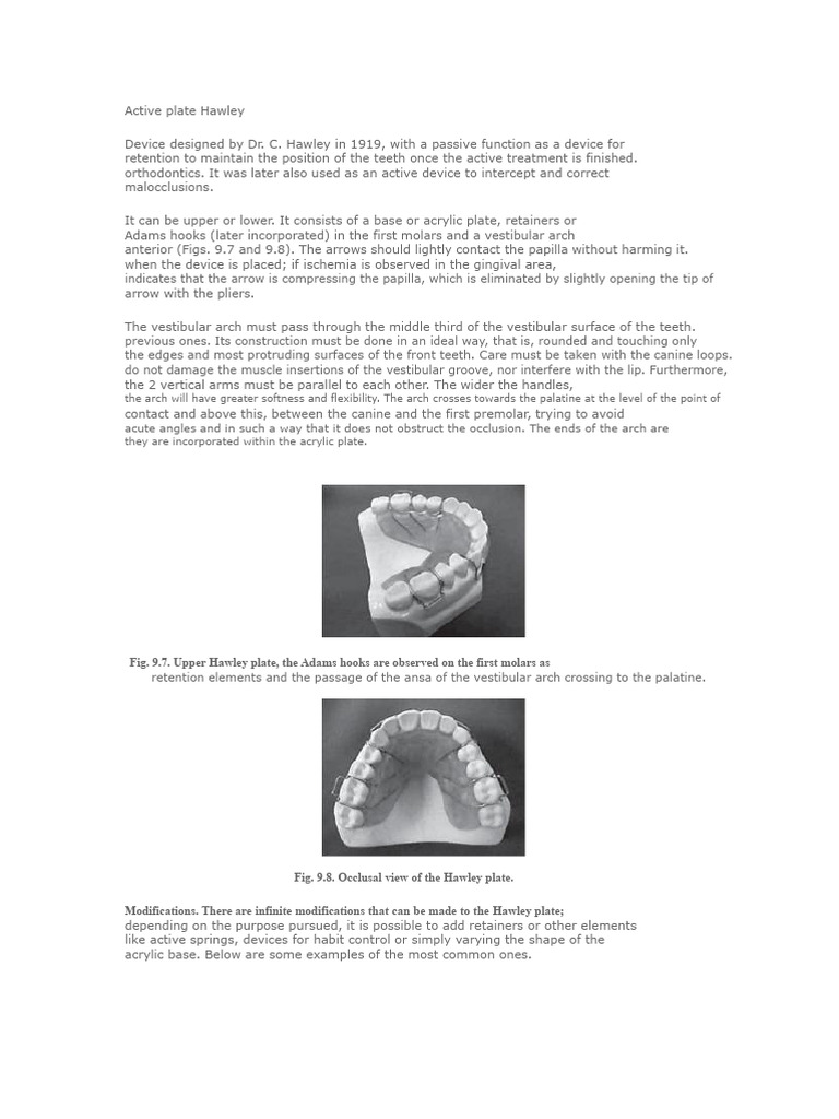 Hawley Plate Orthodontic Device Guide | PDF | Dentistry Branches ...