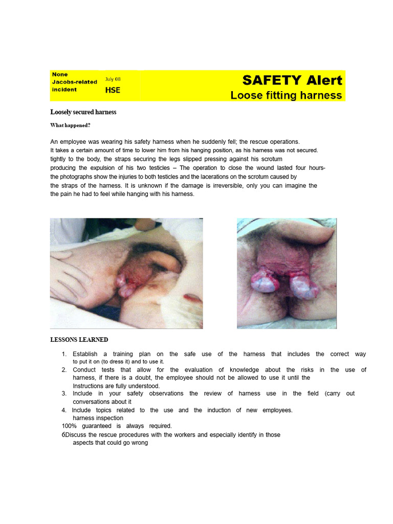 Safety Harness Use and Training Guide | PDF | Wound
