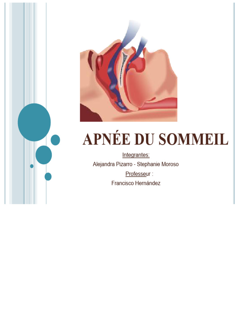 Comprendre l'apnée du sommeil | PDF | Syndrome d'apnées du sommeil ...