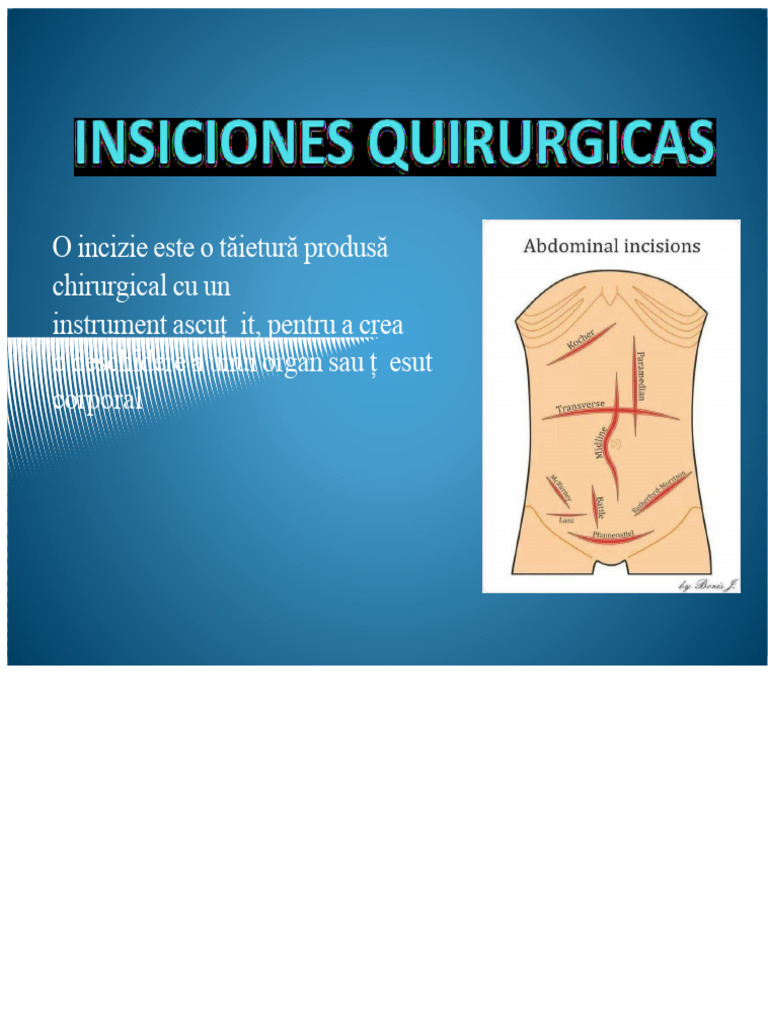 Incizii Chirurgicale | PDF