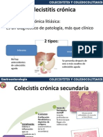 Colecistitis Crónica