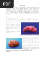 Download Sarna comn de la papa by Jos Luis Pare SN95272790 doc pdf