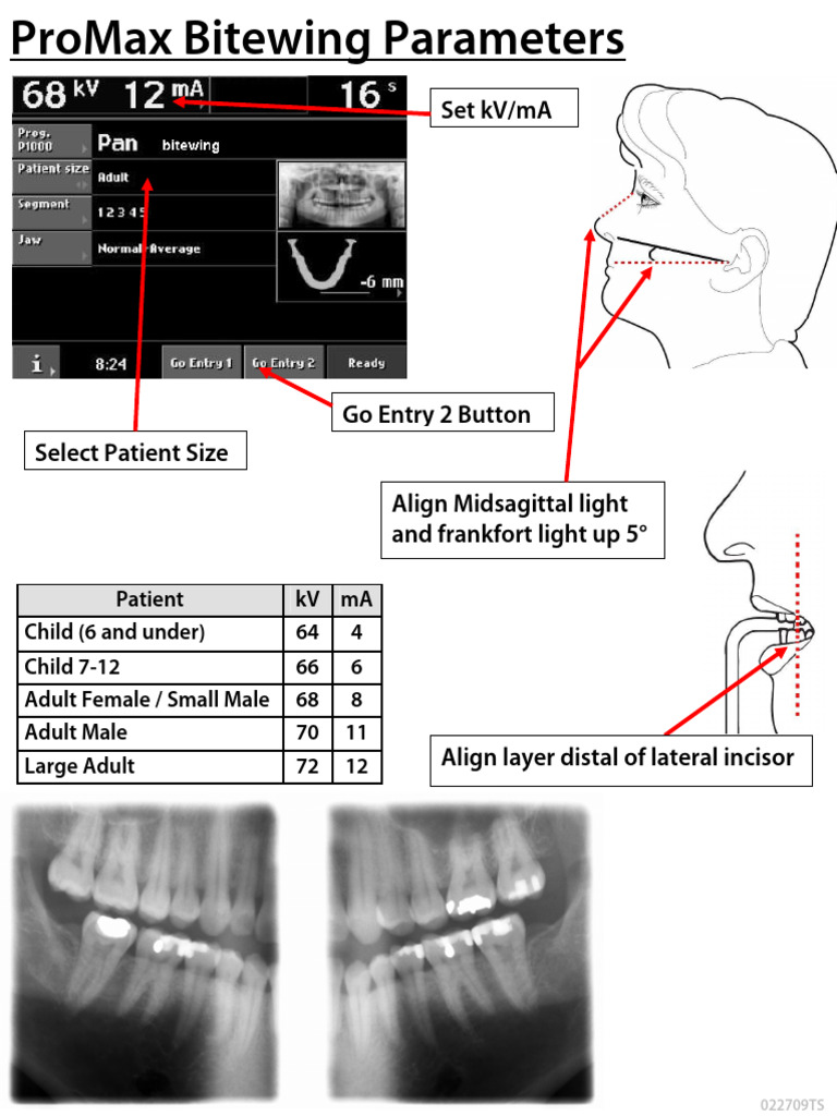 ProMax Bitewing Imaging Parameters | PDF