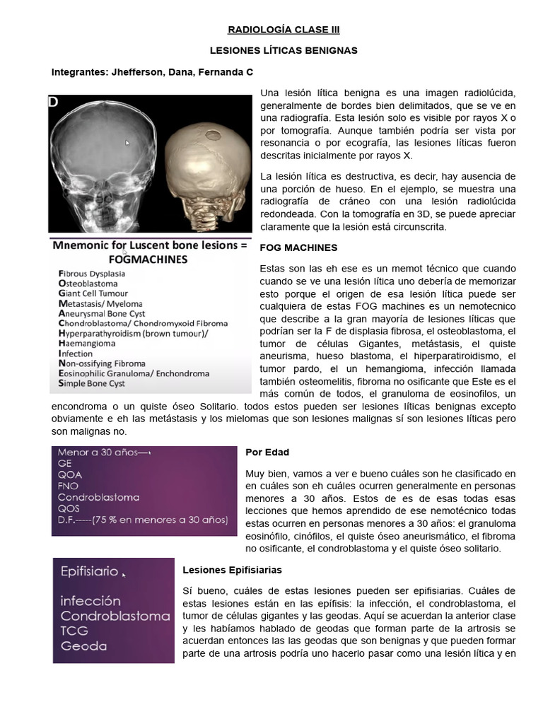 Lesiones Líticas Benignas en Radiología | PDF | Hueso | Sistema ...