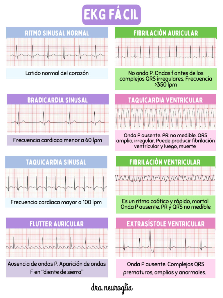 Alteraciones del Ritmo Cardíaco y EKG | PDF | Electrofisiología ...