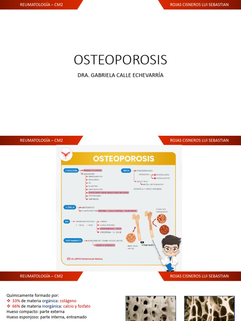 Guía Completa sobre Osteoporosis | PDF | Hueso | Osteoporosis
