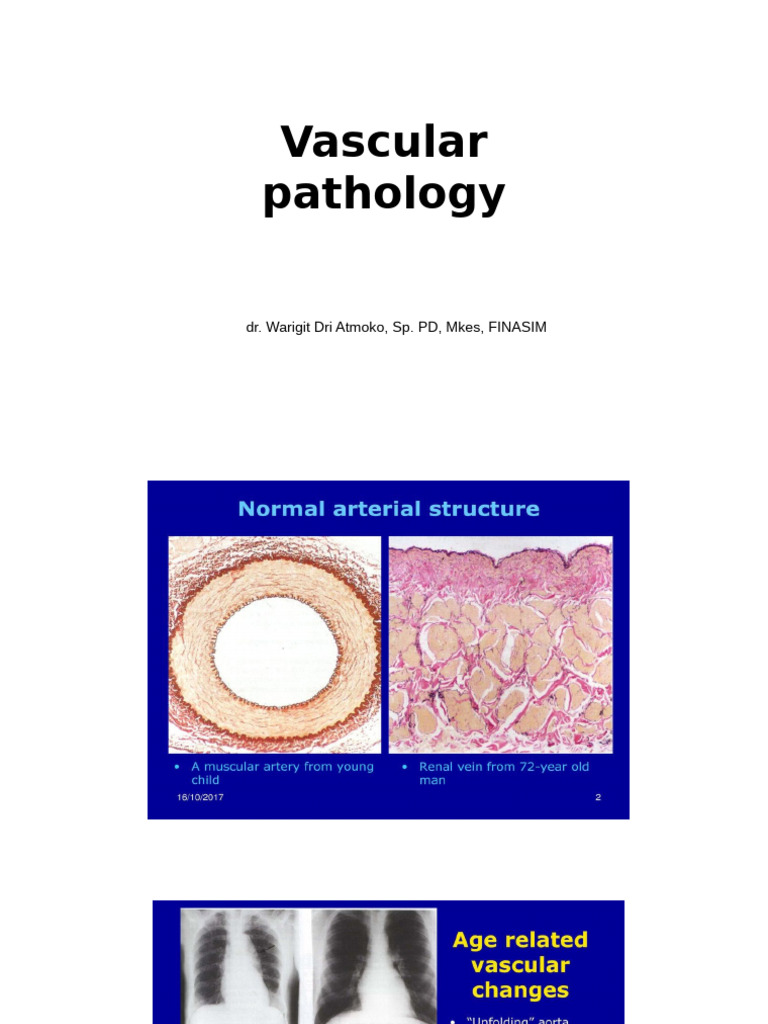 Vascular Patology PPT Terbaru | PDF | Hypertension | Blood Vessel
