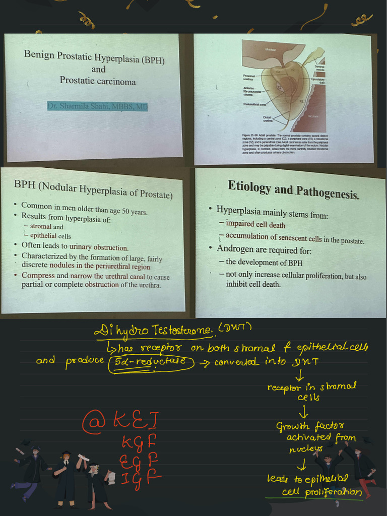 BPH and Prostatic Carcinoma | PDF