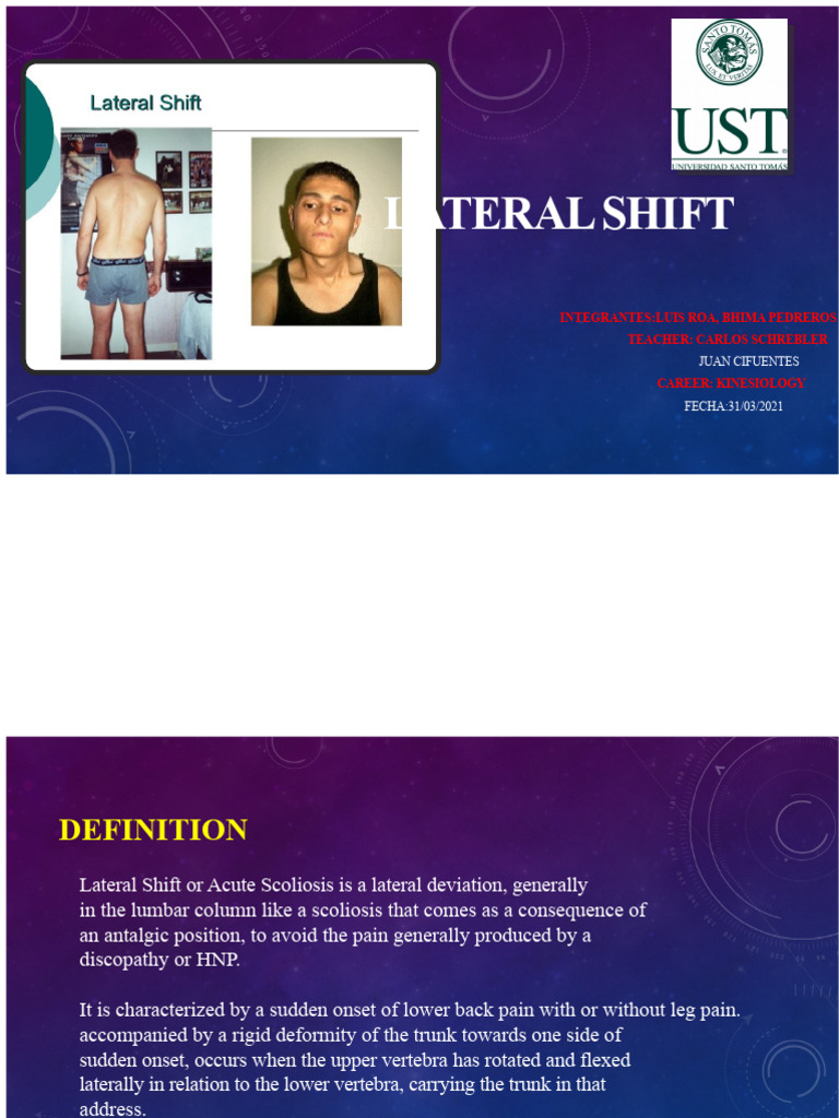 Lateral Shift | PDF | Vertebra | Scoliosis