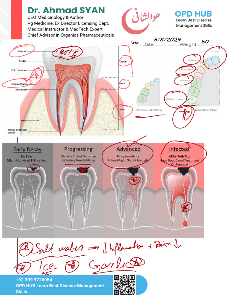 Toothache Diagnosis and Treatment Guide | PDF | Mouth | Symptoms And Signs