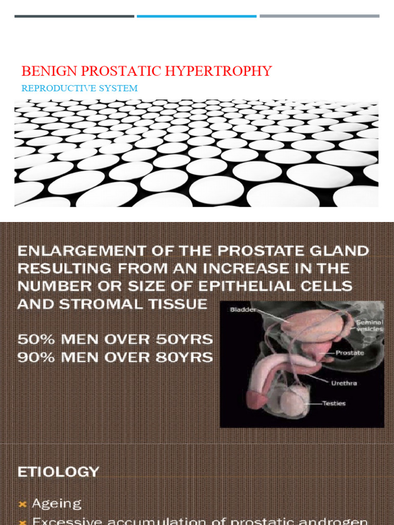 Benign Prostatic Hypertrophy | PDF