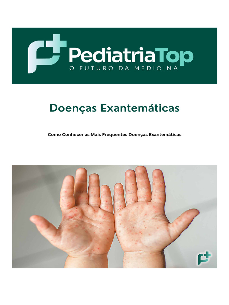 Doenças Exantemáticas: Tipos e Sintomas | PDF | Ciências da Saúde ...