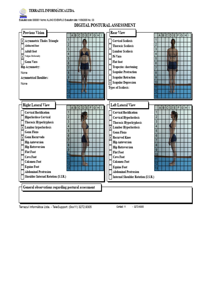 Digital Postural Assessment - Exc | PDF | Scoliosis | Foot