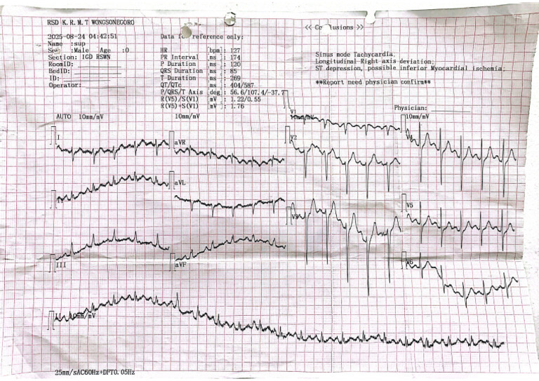 Scan Ekg | PDF