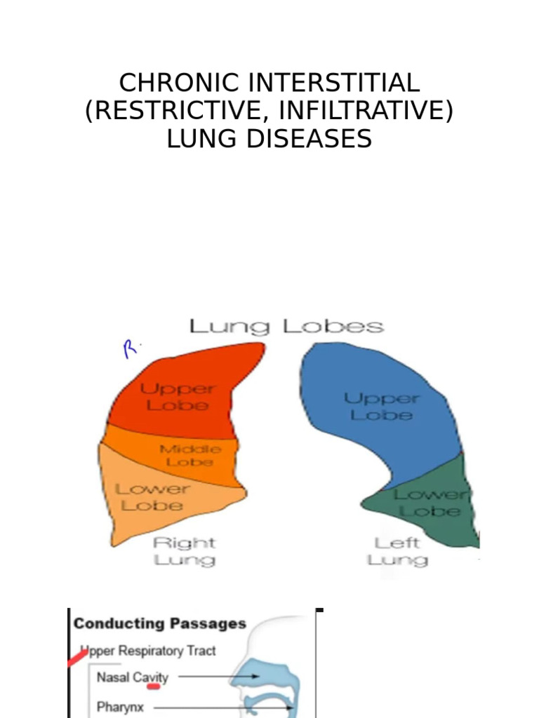 Chronic Interstitial Lung Diseases Overview | PDF | Lung ...