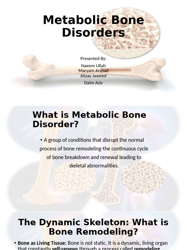 Metabolic Bone Disorder | PDF | Osteoporosis | Bone