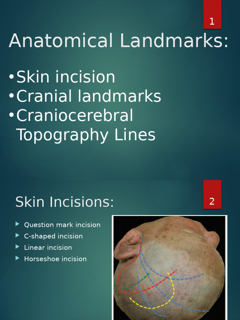 Neurosurgery Incisions Landmarks | PDF | Skull | Human Anatomy
