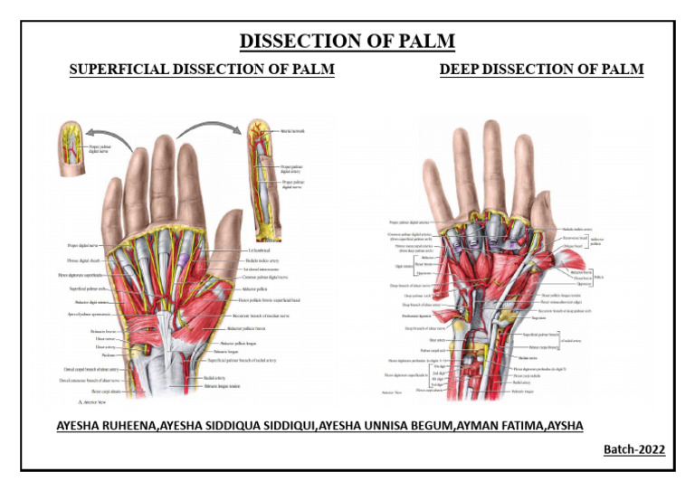 Dissect T | PDF