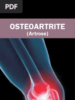 Osteoartrite - SBR