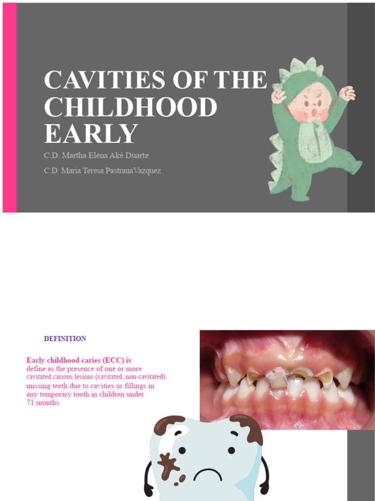 Early Childhood Caries Corrected | PDF | Human Tooth | Tooth Enamel
