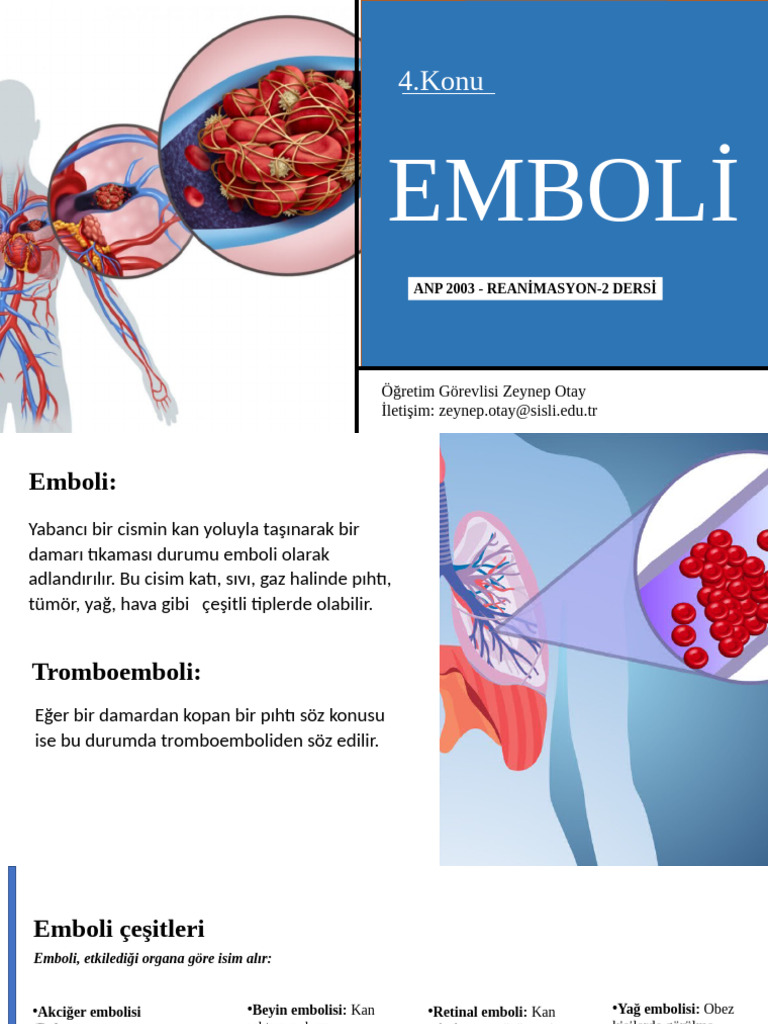 Emboli | PDF