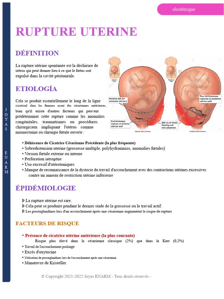 Rupture utérine : causes et traitement | PDF | Accouchement | Césarienne