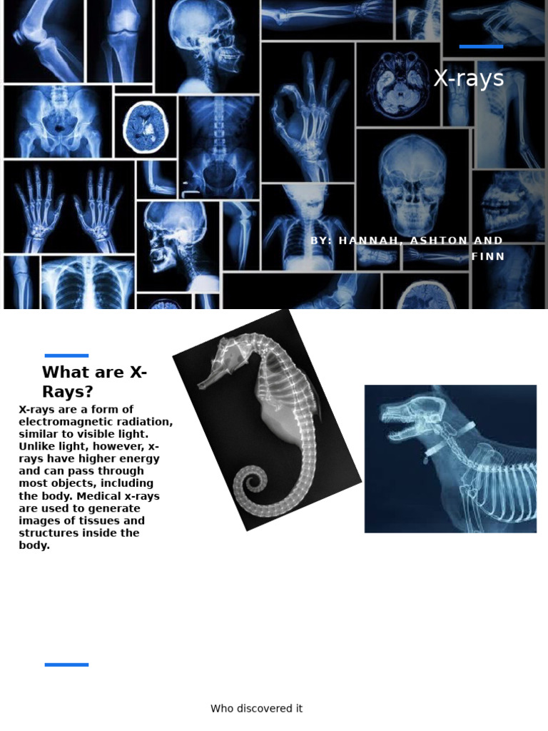 History and Discovery of X-Rays | PDF