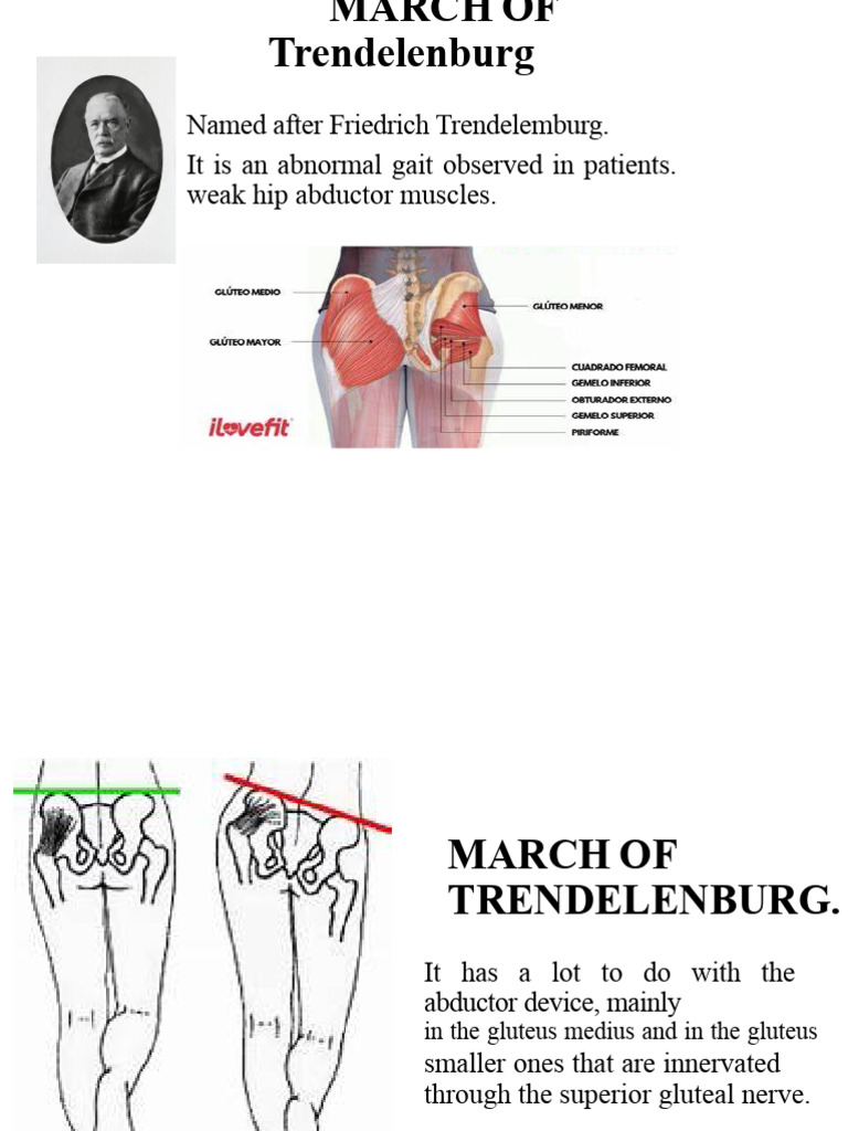 Understanding Trendelenburg Gait Causes | PDF