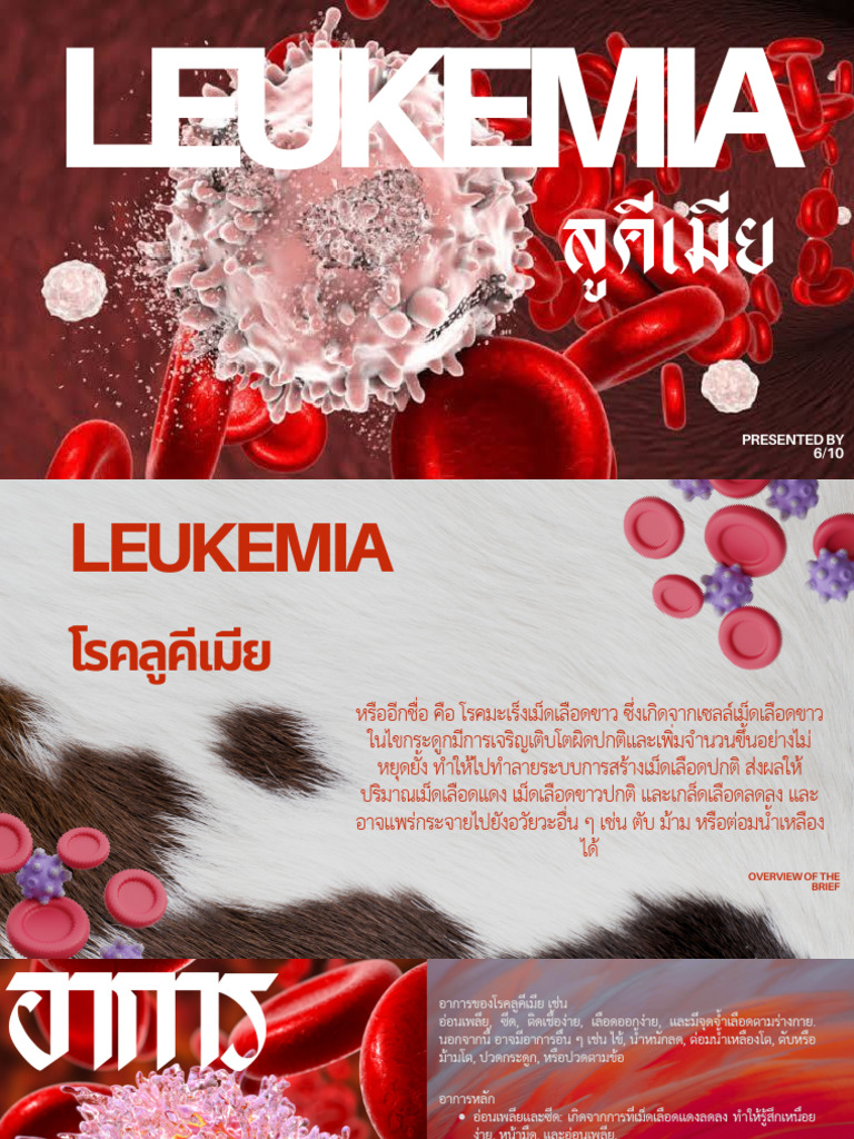 Leukemia | PDF
