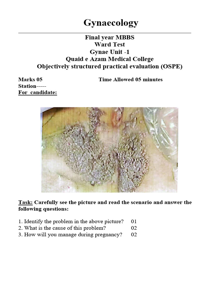 Gynae OSPE Sets 1-6 | PDF | Gynaecology | Miscarriage