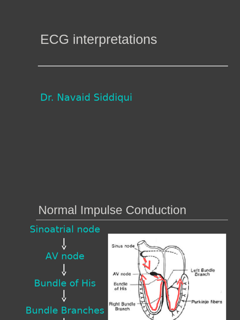 ECG Rhythm Interpretation Guide | PDF | Electrocardiography | Physiology