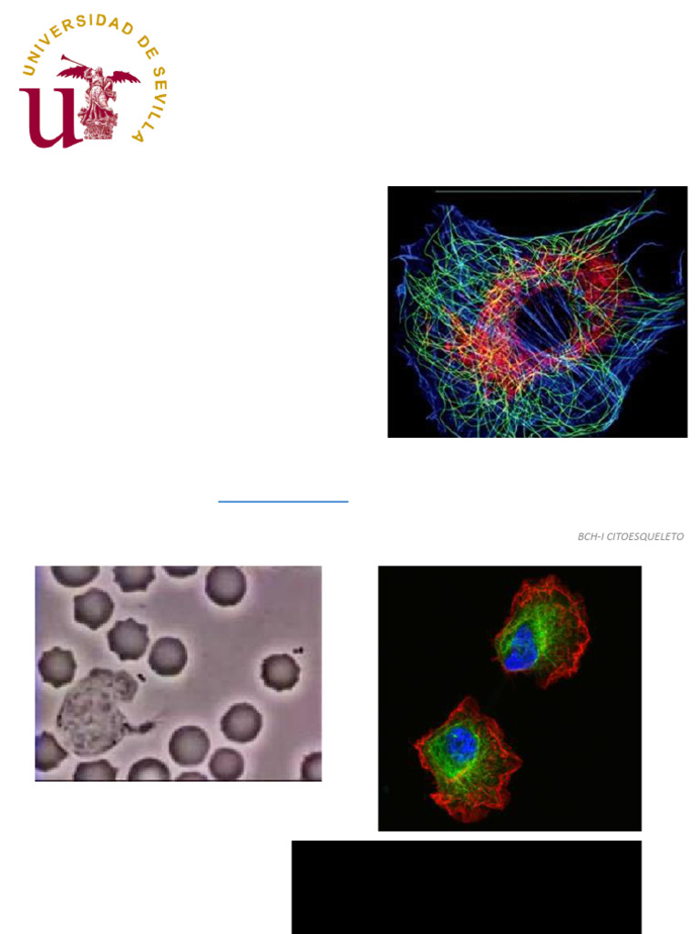 BCHI - T5 - Citoesqueleto - 2020-21 Subrayado BCH I | PDF ...