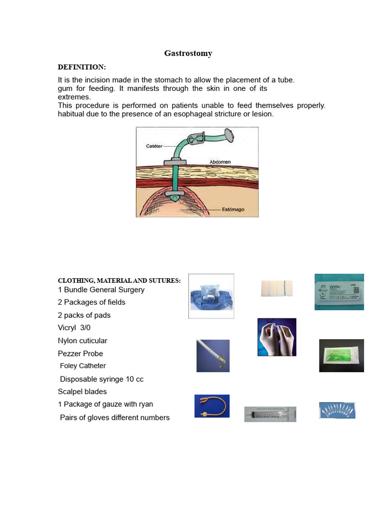 GASTROSTOMY | PDF | Surgical Suture | Surgery