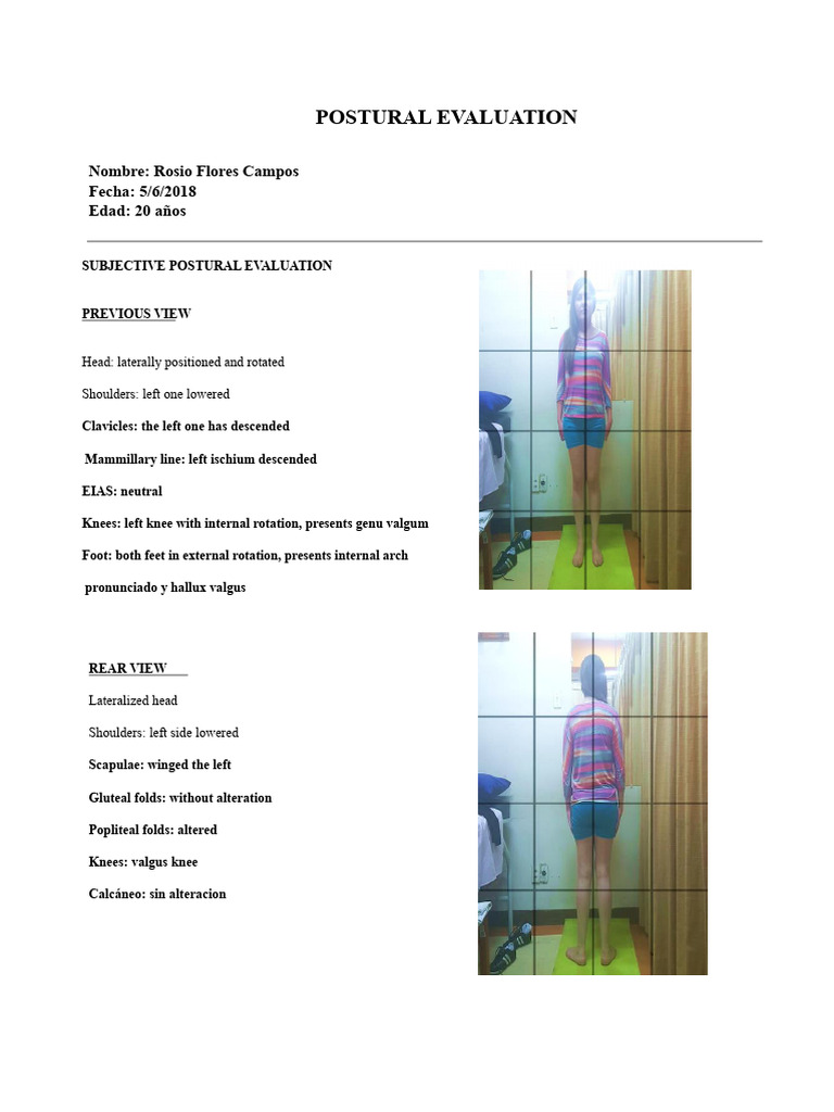 POSTURAL EVALUATION, Examples in Different Planes | PDF