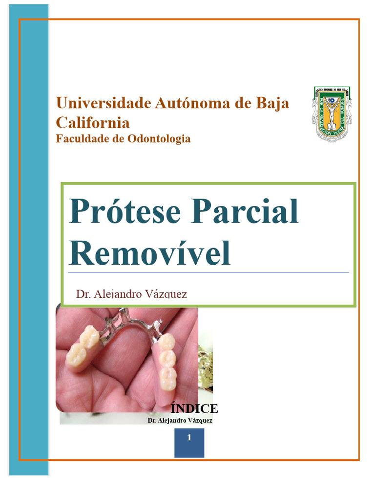 Prótese Parcial Removível: Guia Completo | PDF | Dente humano ...