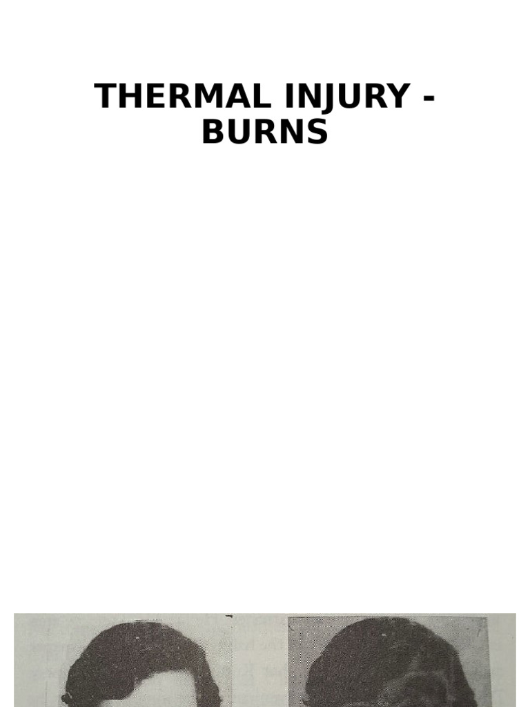 Understanding Burn Types and Effects | PDF | Burn | Stomach