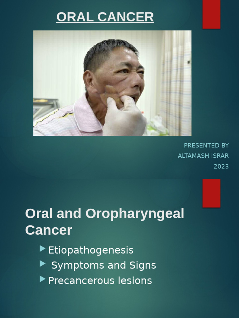 Oral Cancer: Etiology and Symptoms | PDF | Medical Specialties ...